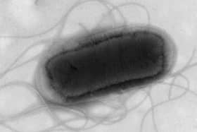 The UK Health Security Agency (UKHSA) has reported that an E. coli outbreak, suspected to be associated with a nationally distributed food item or several items.