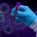 Almost 600 people in Scotland are thought to have caught coronavirus at their place of work but unions claim this is likely just the tip of the iceberg.