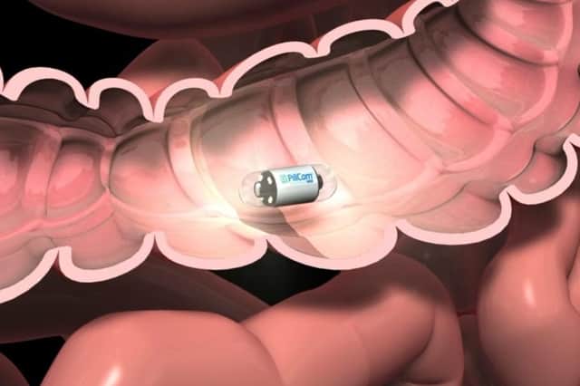The capsule passes through the digestive system capturing thousands of images of the lining of the bowel to help identify any signs of disease.