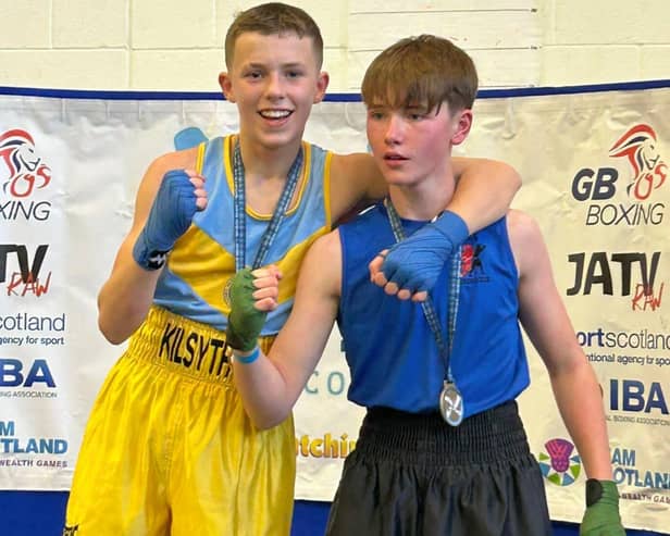 Dennyloanhead’s Jamie Munro, left, after his fight with Aberdeen ace Danny Murphy (Photo: Submitted)