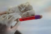 Confirmed cases of omicron in Forth Valley have shown a big jump