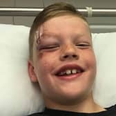 Denny eight-year-old Calvin Duff was knocked down by a van in the town's Dryburgh Avenue on Monday. Contributed.