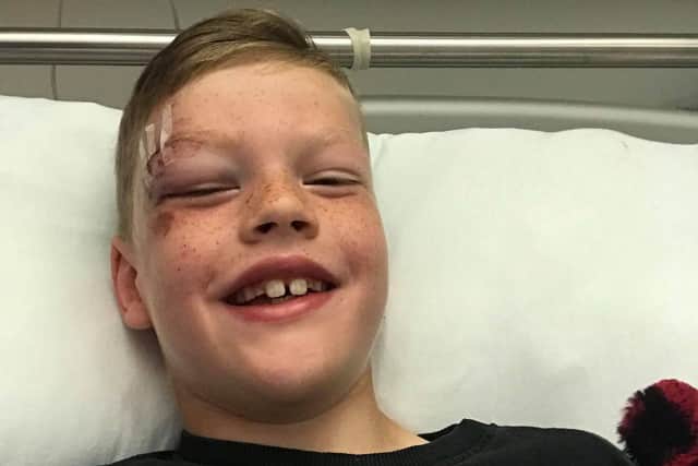Denny eight-year-old Calvin Duff was knocked down by a van in the town's Dryburgh Avenue on Monday. Contributed.