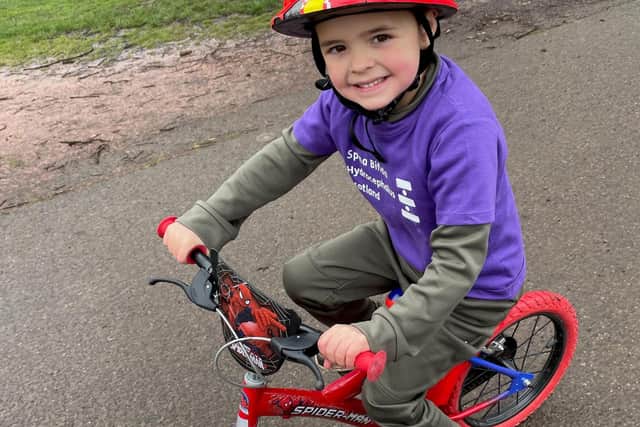 Theo Hardie, aged five, is riding 100 miles to raise money for Spina Bifida Hydrocephalus Scotland as the charity supports his little brother and their family.