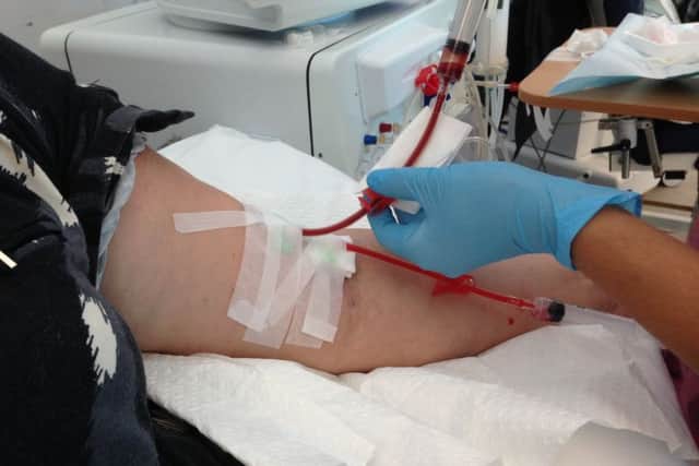 NHS Forth Valley say 20 people received kidney transplants last year  the highest ever number for the area