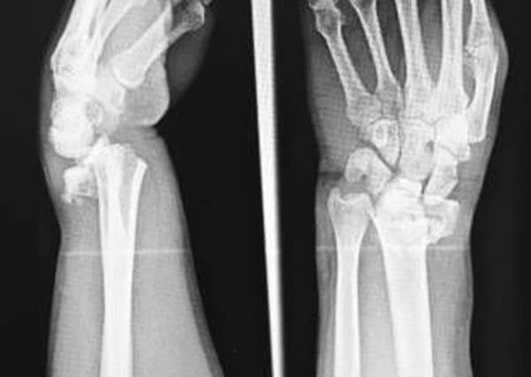 Kellys struggles resulted in a police officer getting x-rays for his injured thumb