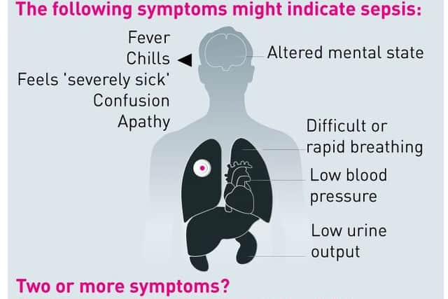 Knowing the symptoms...of sepsis could help save your life so it's worth taking the time to watch the FEAT video - it's only 120 seconds out of your day, but it could save your life.